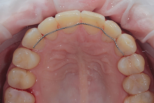 Ретенционный период